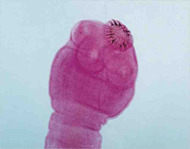 Taenia Solium Slide 