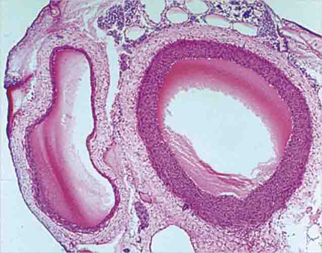 Artery and Vein Slide