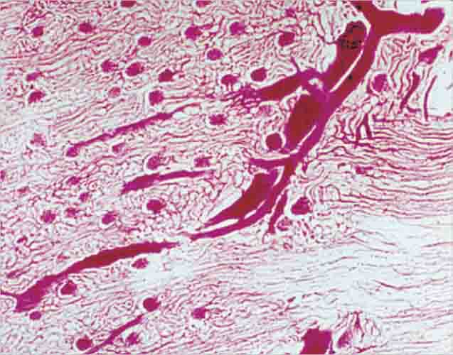  Kidney with Blood Vessels Slide
